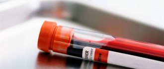 анализы на билирубин