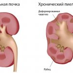 Антибиотики макролиды. Список препаратов для детей, взрослых, беременных