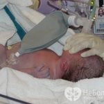 Асфиксия новорожденных проявляется нарушением дыхательной функции