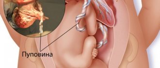 Pregnancy