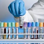 биохимический анализ крови в спб