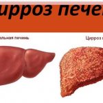 Боль в правом подреберье спереди. Причины, возможные заболевания. Лечение, диагностика