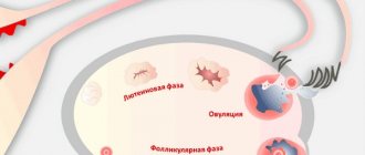 Болезненная овуляция. Причины, симптомы, чем обезболить, лечение и профилактика