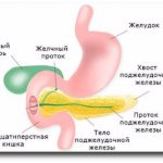 Bulbitis - what kind of disease is this?