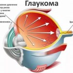 Чем опасно повышение внутриглазного давления