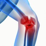 Что именно болит в колене?