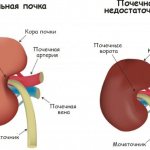 Циннабсин (Cinnabsin) для детей. Отзывы, инструкция по применению