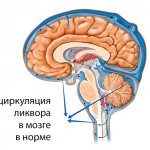 Циркуляция ликвора в мозге