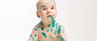 Действие зеленки