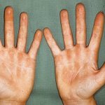 Дермазин - официальная инструкция по применению