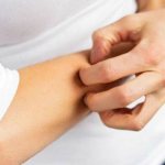 Girl scratching the skin of her hand