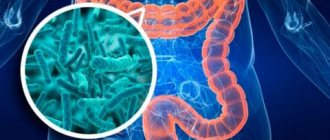 Дисбактериоз