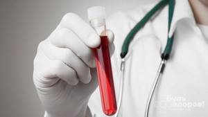 Для определения уровня PLT необходимо сдать общий анализ крови