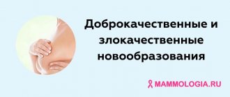 Benign and malignant neoplasms of the breast