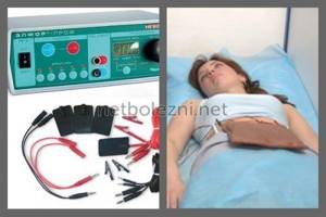 Электрофорез в гинекологии