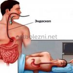 Эндоскопия органов ЖКТ