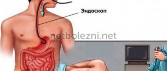 Endoscopy of the gastrointestinal tract