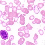 эозинофилы под микроскопом