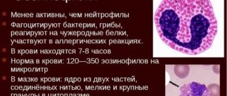 Эозинофилы повышены у взрослого. Что это, причины, симптомы, анализы и лечение
