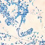 Фармакологические свойства препаратов Дермазол