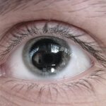 Irifrin eye drops for adults and children