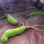 Helicobacteriosis. Symptoms and treatment for adults, children 