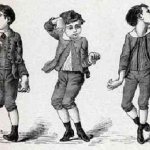 Хореический гиперкинез