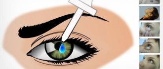 Using eye drops