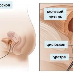 Изображение 1: Цистоскопия - клиника Семейный доктор