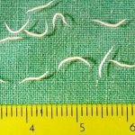 Изображение 1: Энтеробиоз - клиника Семейный доктор