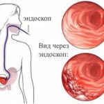 Image 1: Gastritis - Family Doctor Clinic