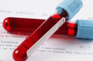 Как расшифровка общего анализа крови помогает врачу поставить диагноз