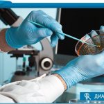 how to take sputum for analysis