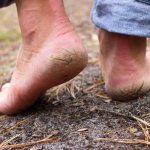 How to remove cracked heels at home. Recipes and techniques 