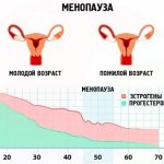 Как выбрать противозачаточные свечи, какие лучше после 40 лет, при грудном вскармливании, негормональные. Отзывы