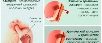 Кальция карбонат (Calcii carbonas). Что это такое, инструкция по применению, аналоги, цена, отзывы