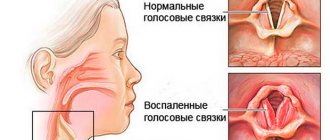 Капли Беродуал – как применять детям и взрослым