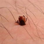 Клещевой энцефалит симптомы и лечение