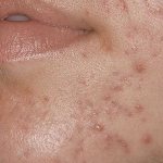 комфодерм состав мази