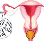 Complex medicinal product Tantum Rose - action and effectiveness