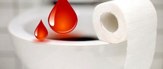 Кровь при дефекации