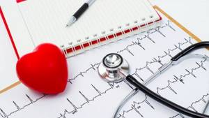 Лечение аритмии сердца