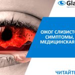 лечение ожога глаз
