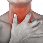 Лечение тонзилита