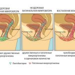 Лекарственное средство Вагилак - для чего назначают и как им пользоваться?