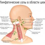 Лимфоузлы на шее - фото