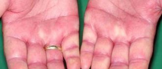 метипред таблетки