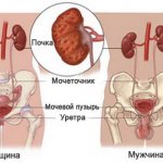 мочевыводящие пути