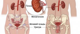 мочевыводящие пути
