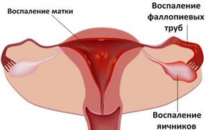 Нарушение менструационного цикла. Причины у подростков, женщин, после противозачаточных, родов, при грудном вскармливании